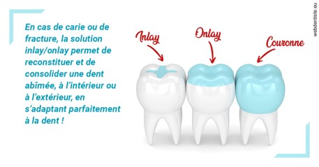 https://scp-chirurgien-dentiste-anais-freckhaus.chirurgiens-dentistes.fr/L'INLAY ou l'ONLAY