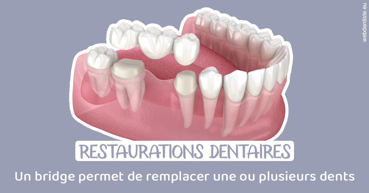 https://scp-chirurgien-dentiste-anais-freckhaus.chirurgiens-dentistes.fr/Bridge remplacer dents 1