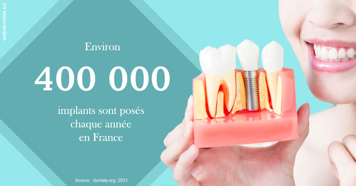 https://scp-chirurgien-dentiste-anais-freckhaus.chirurgiens-dentistes.fr/Pose d'implants en France 2
