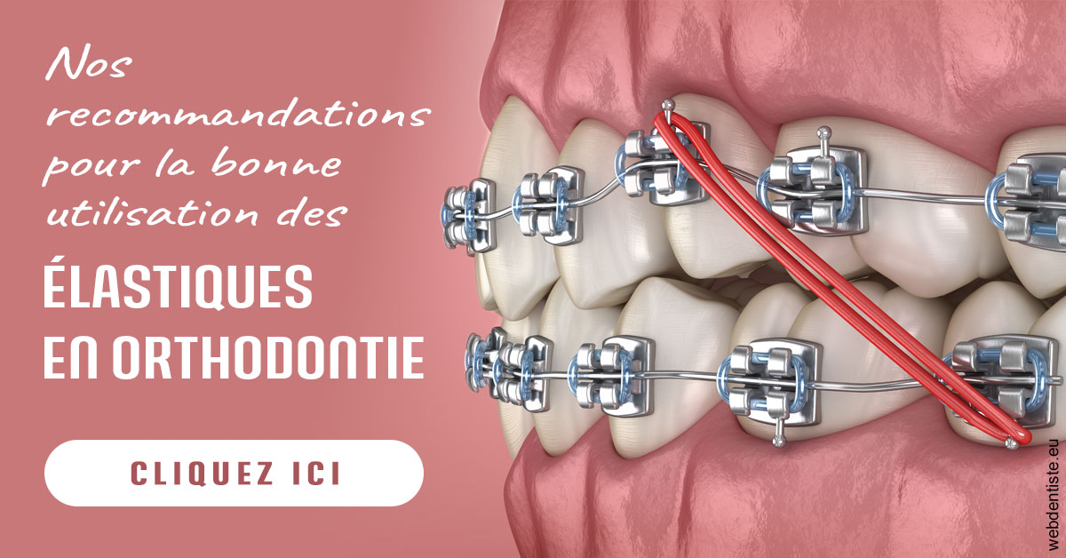 https://scp-chirurgien-dentiste-anais-freckhaus.chirurgiens-dentistes.fr/Elastiques orthodontie 2